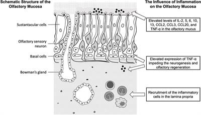 Studies on Clinical Features, Mechanisms, and Management of Olfactory Dysfunction Secondary to Chronic Rhinosinusitis